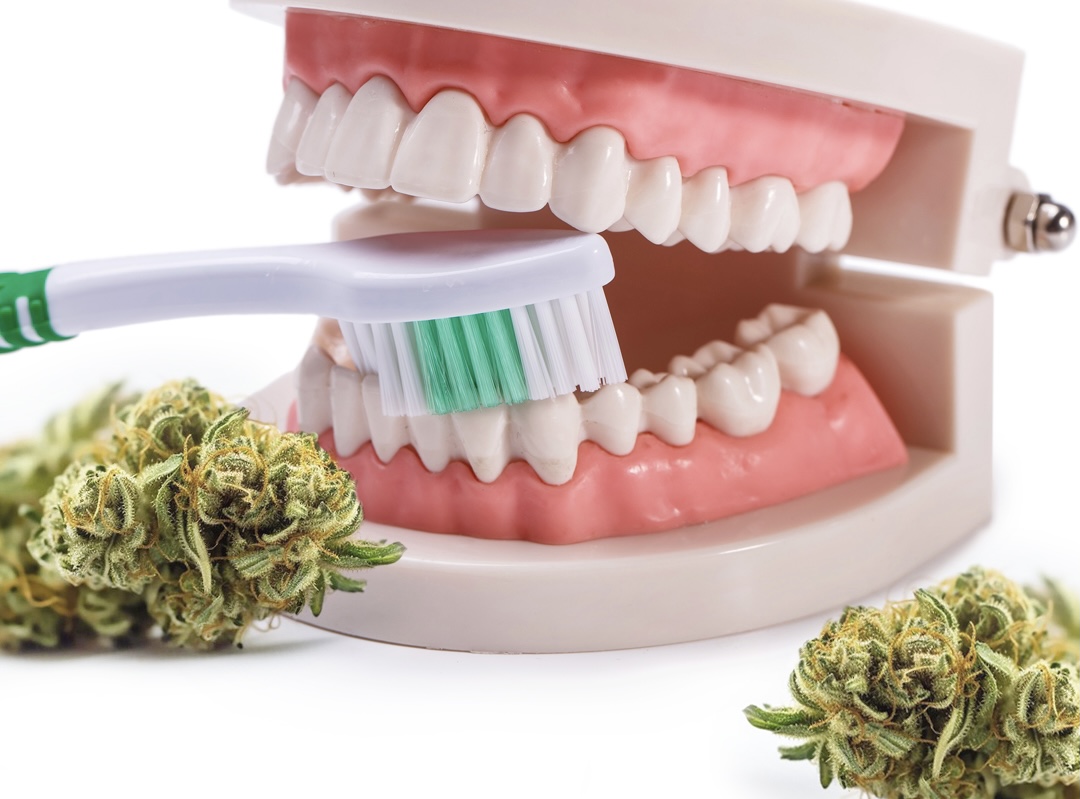 Cannabis Medicinal na Odontologia: Aplicações surpreendentes